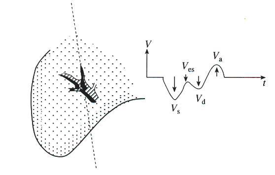 Fig. 2. Profile of blood flow velocity in the hepatic vein in healthy subjects.